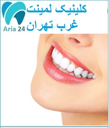کلینیک لمینت دندان غرب تهران | مشاوره رایگان : 02122366650